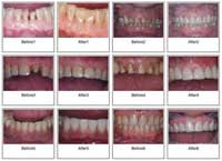 dental treatment results